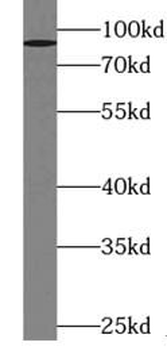 ZNF746 Antibody抗体，orb632821，bi