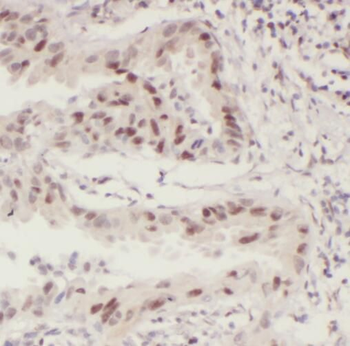 STAT5B Antibody抗体，orb631572，bi