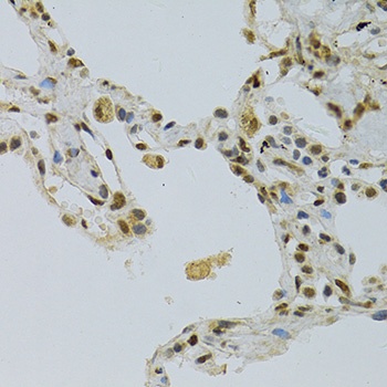 NLK Antibody抗体,orb1254644,bior