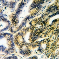 PTPD1 Antibody抗体，orb304532，bio