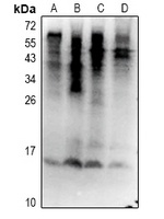 Ubiquitin (Phospho-S65) Antibo