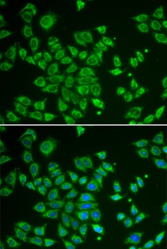 SMAD1 Antibody抗体,orb1261320,bi