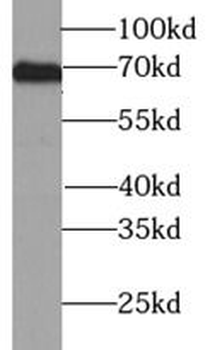 TYR Antibody抗体，orb632933，biorb