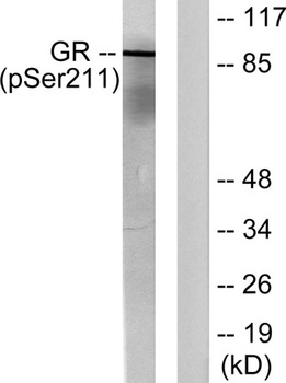 GR (phospho Ser211) rabbit pAb