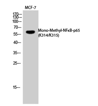 NFκB-p65 (Mono Methyl Lys314/L