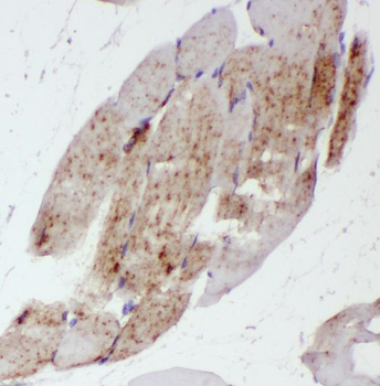 ST3GAL5 Antibody抗体，orb631539，b
