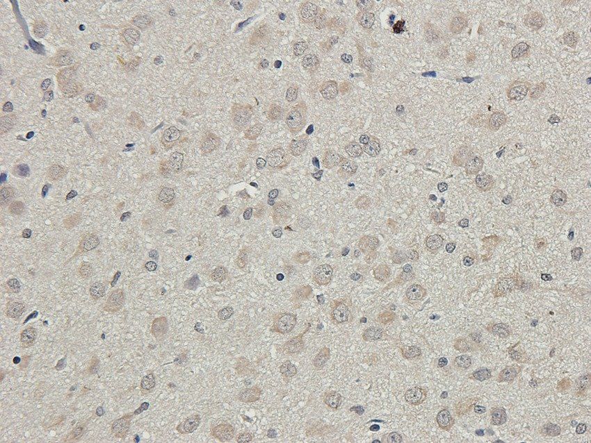 SLC6A5 antibody抗体，orb395803，bi