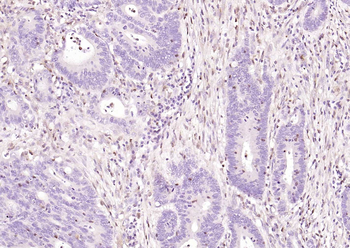 S100A4 Mouse Monoclonal Antibo