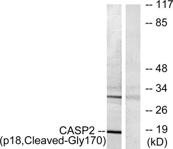 Cleaved-Caspase-2 p18 (G170) r