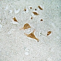 CDK5RAP1 Antibody抗体，orb665763，