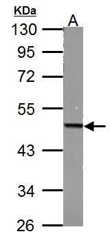 Fumarate hydratase antibody [N