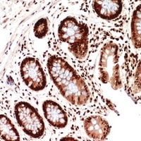 HLA-DQB1 Antibody抗体,orb234873,