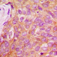 IRS1 (Phospho-S1101) Antibody抗