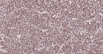 Bcl-2 Recombinant Rabbit Monoc