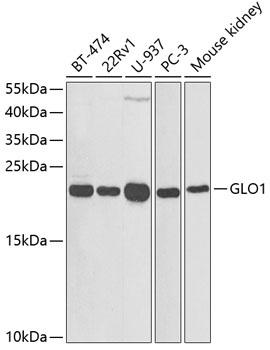 GLO1 Antibody抗体，orb1258383，bio
