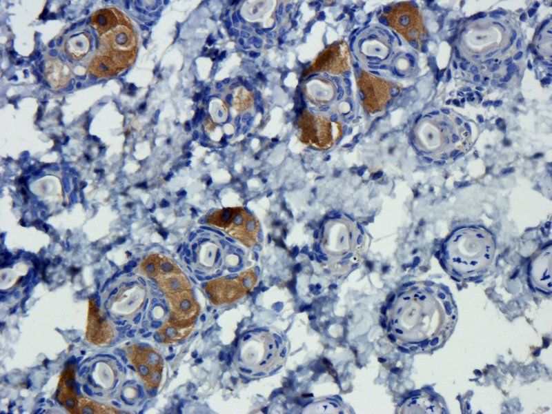 TGF beta 1 antibody抗体，orb11468