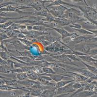 人肺癌成纤维细胞永生化