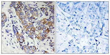 Carbonyl Reductase 1 rabbit pA
