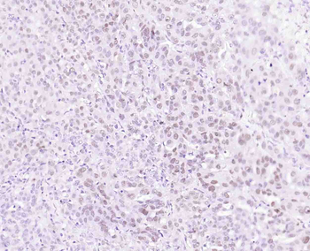 P53 Recombinant Rabbit Monoclo