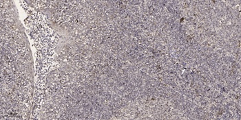 ADCK1 rabbit pAb抗体,orb764476,b