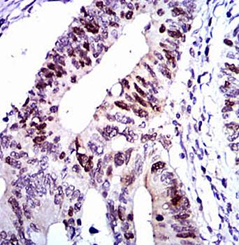 CDK2 Antibody抗体，orb97446，biorb