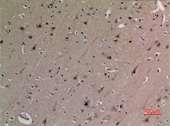 p53 (Acetyl Lys382) rabbit pAb