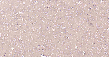 ATP1B1 Recombinant Rabbit Mono