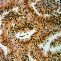 Histone H3 (Acetyl-K122) Antib