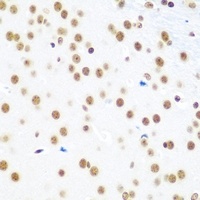 EVI1 Antibody抗体，orb665747，bior