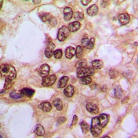 NF-kappaB p105/p50 (Phospho-S3