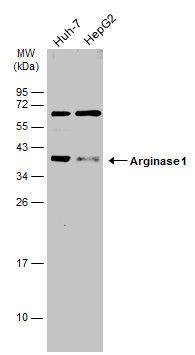 Arginase 1 antibody抗体，orb55659