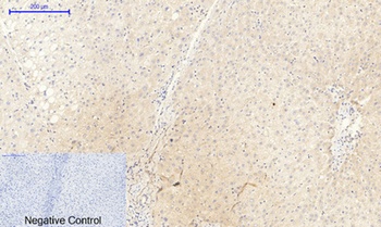 JAK2 (phospho Tyr1007) rabbit 