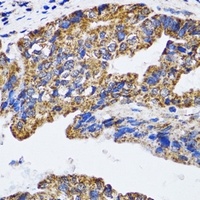 p53 Antibody抗体，orb668471，biorb