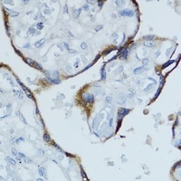 Cytochrome P450 19A1 Antibody抗