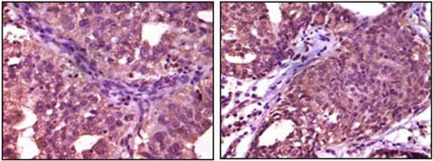 EphA1 Antibody抗体，orb97504，bior