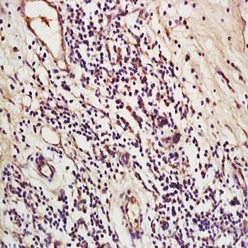 LOXL2 antibody抗体，orb100924，bio