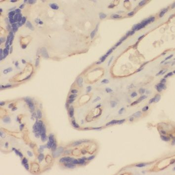 TRPC6 Antibody抗体，orb632180，bio