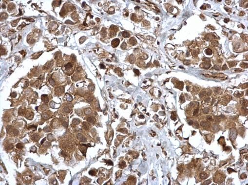 EPS8 antibody [C3], C-term抗体，o