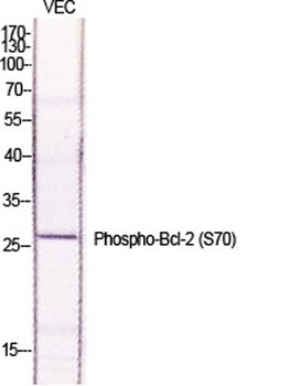 Bcl-2 (phospho Ser70) rabbit p