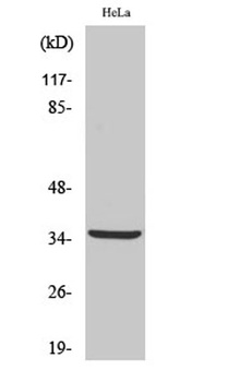 Cleaved-Cathepsin L2 (L114) ra