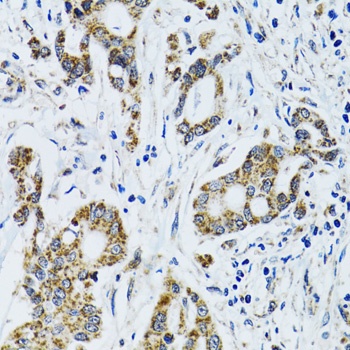 GAB1 Antibody抗体，orb1257137，bio