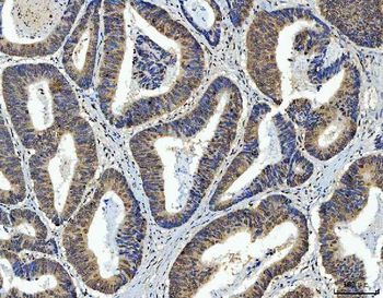 AREB6/ZEB1 Antibody (monoclona