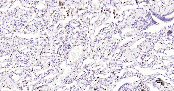 5 Lipoxygenase Recombinant Rab