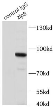 SLC39A8 Antibody抗体，orb632730，b