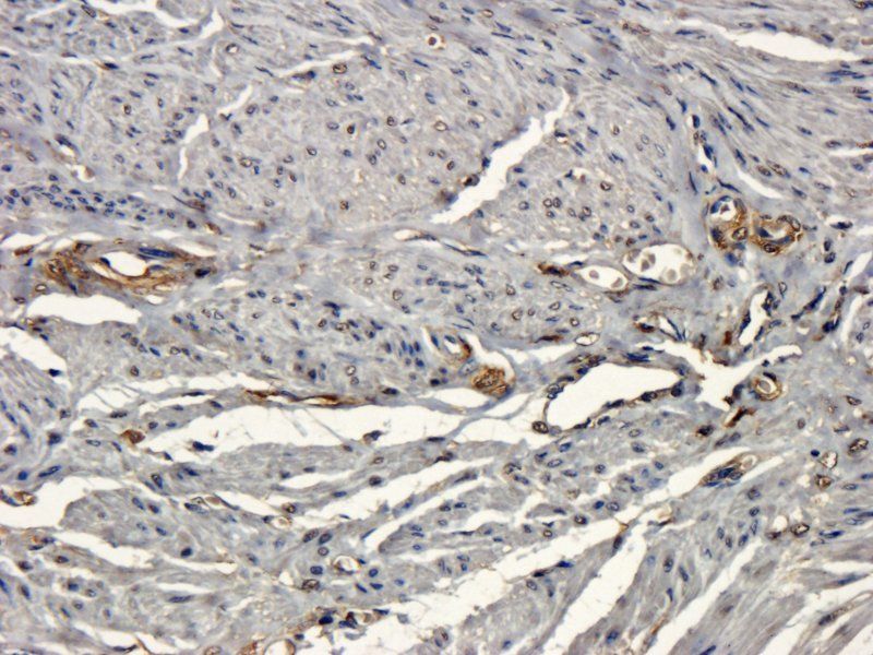 beta 1 Adrenergic Receptor ant