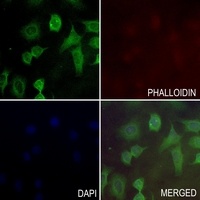 PKLR Antibody抗体,orb215502,bior