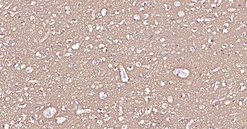 ATP1B1 Recombinant Rabbit Mono