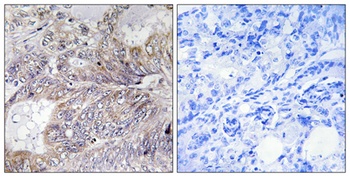 Bad rabbit pAb抗体，orb764618，bio