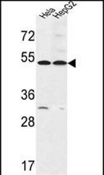 FERMT1 Antibody (Center)抗体,orb
