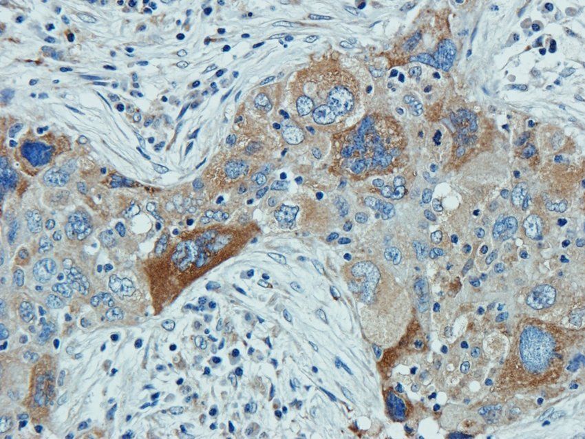 MOGAT1 antibody抗体，orb385431，bi